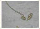 Alternaria