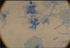 Aspergillus candidus