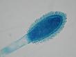 Aspergillus clavatus