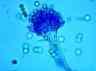 Aspergillus parasiticus