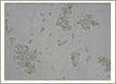 Cladosporium (Hormodendrum)
