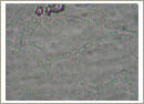Geotrichum