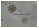 Mucor