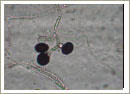 Nigrospora