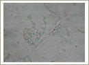 Paecilomyces