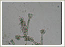Stachybotrys