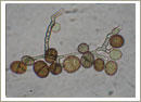 Ulocladium