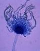 Image Aspergillus flavus